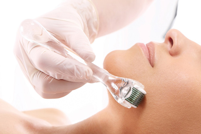 Hướng dẫn cách lăn kim